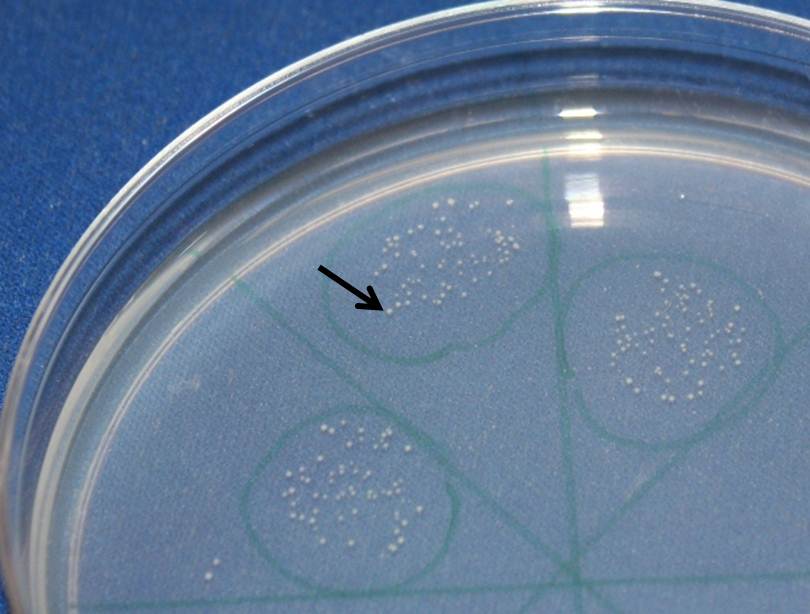 Petri plate showing growth of rhizobial colonies